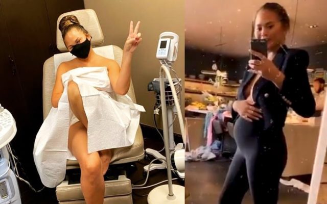 Chrissy Teigen Didn’t Know She Was Pregnant When She Had Her Breast Implants Taken Out