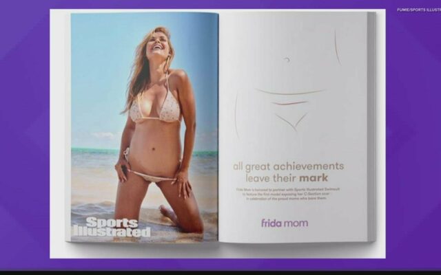 Sports Illustrated Features Model With C-Section Scar
